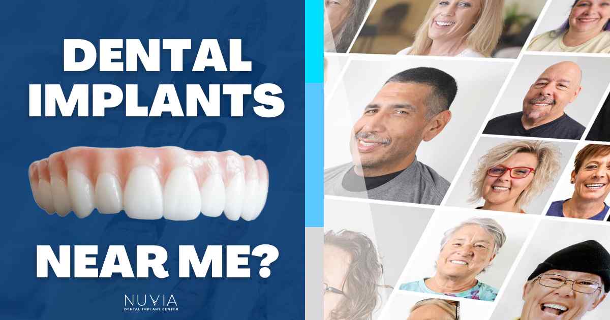 Nuvia Dental Implants Near Me